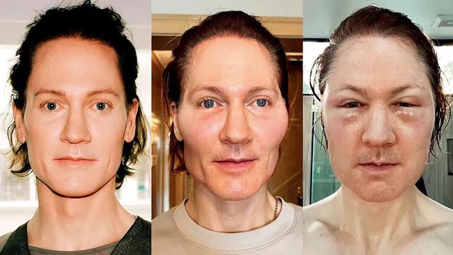 岁儿子换血每年花200万美元开元棋牌拒绝变老！富豪与17(图5)